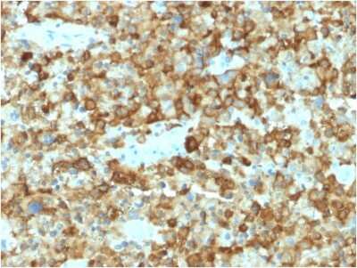 Immunohistochemistry-Paraffin: PMEL17/SILV Antibody (PMEL/2037) - Azide and BSA Free [NBP3-08518]