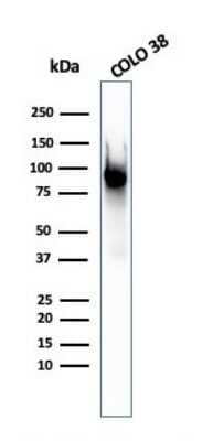 Western Blot: PMEL17/SILV Antibody (PMEL/2037)Azide and BSA Free [NBP3-08518]