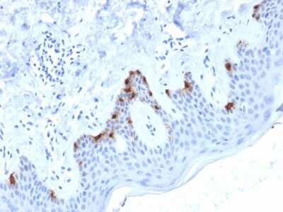 Immunohistochemistry-Paraffin: PMEL17/SILV Antibody (PMEL/2038) - Azide and BSA Free [NBP3-08517]