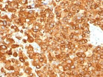 Immunohistochemistry-Paraffin: PMEL17/SILV Antibody (PMEL/783) - Azide and BSA Free [NBP2-47779]