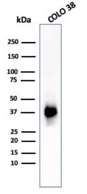 Western Blot: PMEL17/SILV Antibody (PMEL/783)Azide and BSA Free [NBP2-47779]