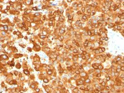 Immunohistochemistry-Paraffin: PMEL17/SILV Antibody (PMEL/783) - IHC-Prediluted [NBP2-48341]