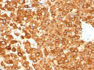 Immunohistochemistry-Paraffin: PMEL17/SILV Antibody (PMEL/783) [NBP2-44522]