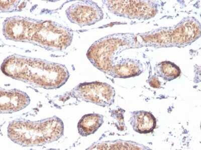 Immunohistochemistry-Paraffin: PMEL17/SILV Antibody (PMEL/783) [NBP2-44522]