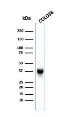 Western Blot: PMEL17/SILV Antibody (SPM142)Azide and BSA Free [NBP2-34739]