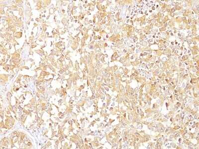 Immunohistochemistry-Paraffin: PMEL17/SILV Antibody (SPM142) - IHC-Prediluted [NBP2-44521]