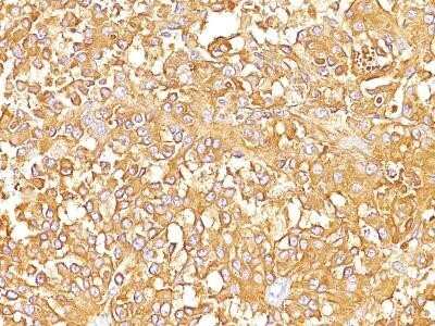 Immunohistochemistry-Paraffin: PMEL17/SILV Antibody (SPM142) - IHC-Prediluted [NBP2-44521]