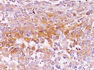 Immunohistochemistry-Paraffin: PMEL17/SILV Antibody (SPM286) - Azide and BSA Free [NBP2-34755]