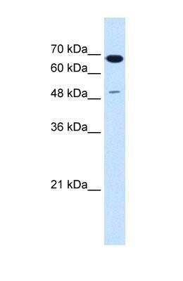 Western Blot: PMEL17/SILV Antibody [NBP1-69571]