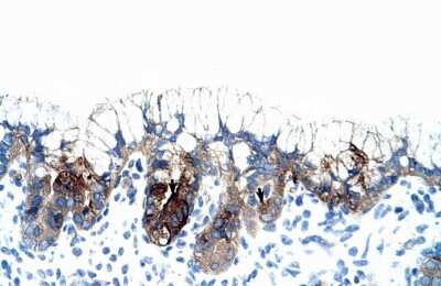 Immunohistochemistry: PMF1 Antibody [NBP2-85503]