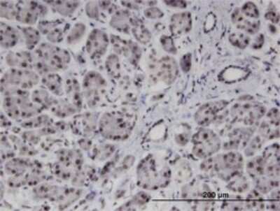 Immunohistochemistry-Paraffin: PMFBP1 Antibody (4G9) [H00083449-M01]