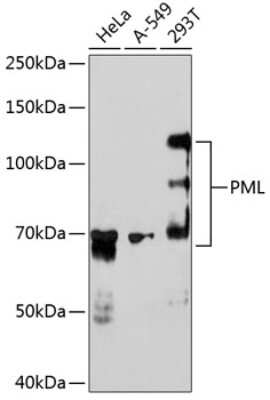 Western Blot: PML Protein Antibody (2A0N10) [NBP3-15835]