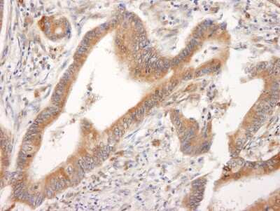 Immunohistochemistry: PML Protein Antibody - BSA Free [NB100-59787]