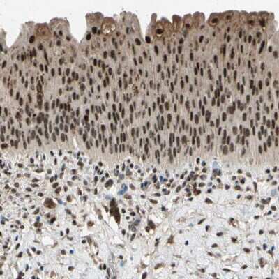 Immunohistochemistry-Paraffin: PML Protein Antibody [NBP1-87783]