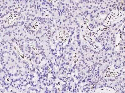 Immunohistochemistry-Paraffin: PML Protein Antibody [NBP2-98822]