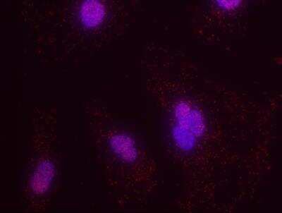 Proximity Ligation Assay: PML Protein AntibodyBSA Free [NB100-59787]