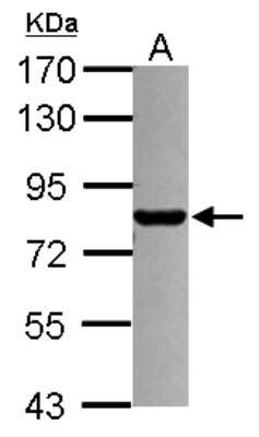Western Blot: PML Protein Antibody [NBP2-19872]