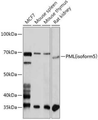 Western Blot: PML Protein AntibodyBSA Free [NBP2-94515]
