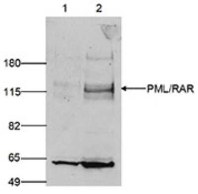 Western Blot: PML Protein Antibody [NBP3-18686]