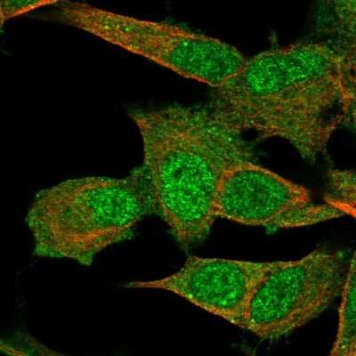Immunocytochemistry/ Immunofluorescence: PMM2/Phosphomannomutase 2 Antibody [NBP2-57753]