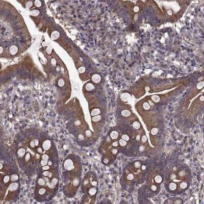 Immunohistochemistry-Paraffin: PMM2/Phosphomannomutase 2 Antibody [NBP2-57753]