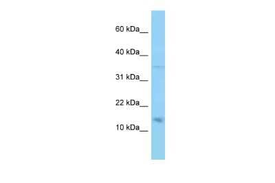 Western Blot: PMP22 Antibody [NBP2-86749]