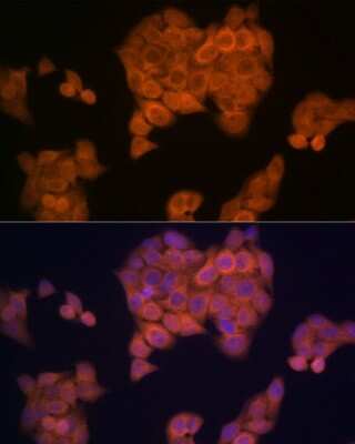 Immunocytochemistry/ Immunofluorescence: PMP70 Antibody (3V4K3) [NBP3-16348]
