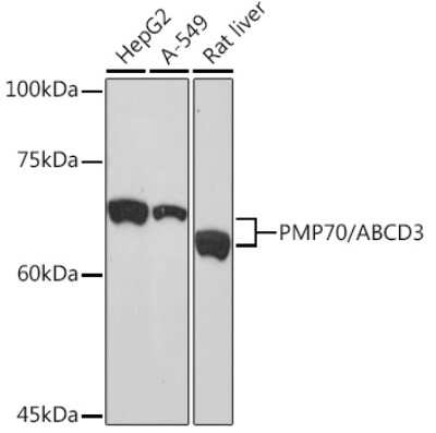Western Blot: PMP70 Antibody (3V4K3) [NBP3-16348]
