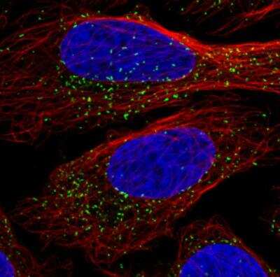 Immunocytochemistry/ Immunofluorescence: PMP70 Antibody (CL2524) [NBP2-36770]