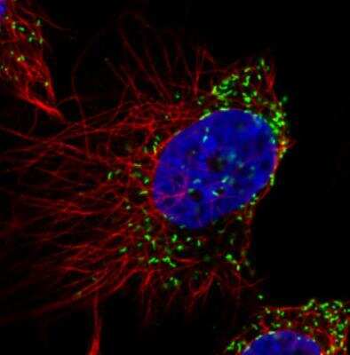 Immunocytochemistry/ Immunofluorescence: PMP70 Antibody (CL2524) [NBP2-36770]