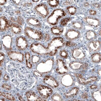 Immunohistochemistry-Paraffin: PMP70 Antibody (CL2524) [NBP2-36770]