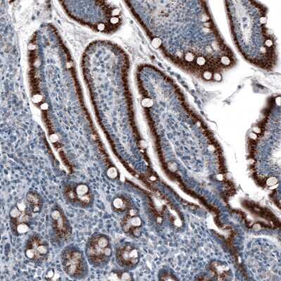 Immunohistochemistry-Paraffin: PMP70 Antibody (CL2524) [NBP2-36770]