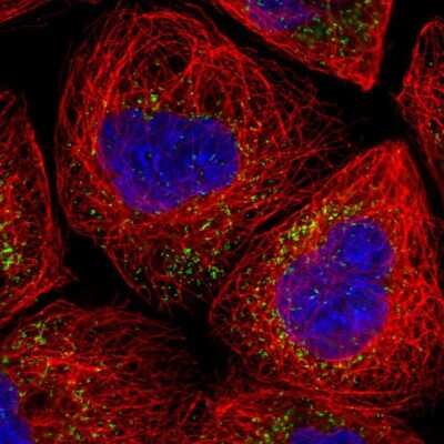 Immunocytochemistry/ Immunofluorescence: PMP70 Antibody [NBP1-87258]