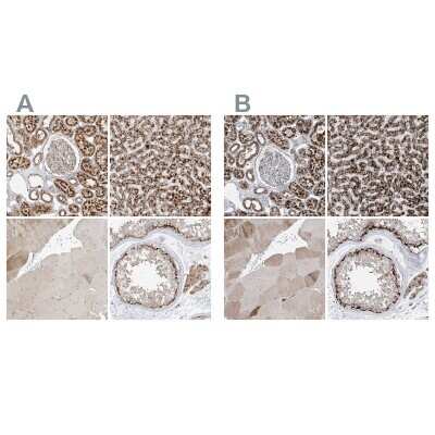 Immunohistochemistry-Paraffin: PMP70 Antibody [NBP2-38199]