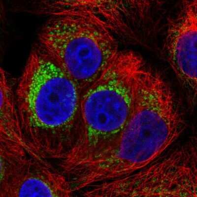 Immunocytochemistry/ Immunofluorescence: PMPCA Antibody [NBP2-57169]