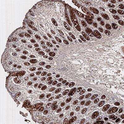 Immunohistochemistry-Paraffin: PMS2 Antibody (163C1251) - BSA Free [NB100-56554]