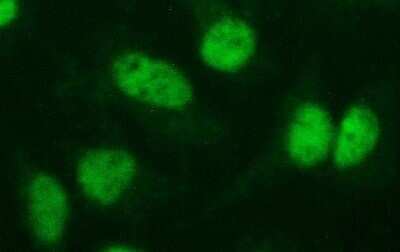 Immunocytochemistry/ Immunofluorescence: PMS2 Antibody (OTI2G5) - Azide and BSA Free [NBP2-73481]