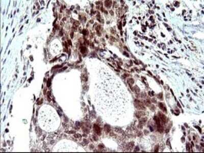 Immunohistochemistry: PMS2 Antibody (OTI2G5) [NBP2-46459]