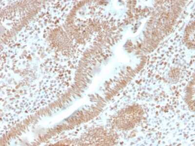 Immunohistochemistry-Paraffin: PMS2 Antibody (PMS2/4373R) [NBP3-07615]
