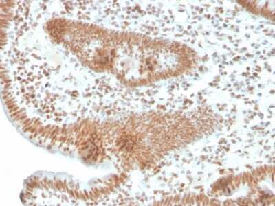 Immunohistochemistry-Paraffin: PMS2 Antibody (PMS2/4373R) - Azide and BSA Free [NBP3-08570]