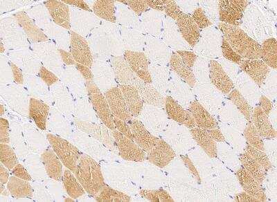 Immunohistochemistry-Paraffin: PMVK/phosphomevalonate kinase Antibody (003) [NBP2-90296]