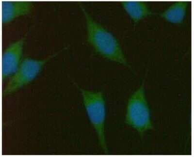 Immunocytochemistry/ Immunofluorescence: PMVK/phosphomevalonate kinase Antibody (21C10) - BSA Free [NBP2-59412]