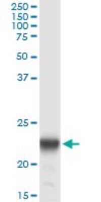 Immunoprecipitation: PMVK/phosphomevalonate kinase Antibody (2B8) [H00010654-M07]
