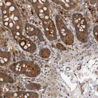 Immunohistochemistry-Paraffin: PMVK/phosphomevalonate kinase Antibody [NBP1-83142]