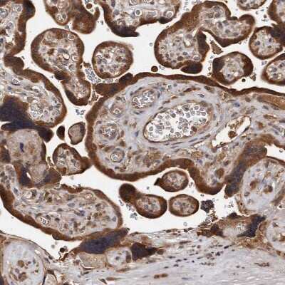 Immunohistochemistry-Paraffin: PMVK/phosphomevalonate kinase Antibody [NBP1-83142]