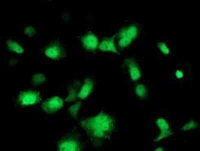 Immunocytochemistry/ Immunofluorescence: PMVK/phosphomevalonate kinase Antibody (OTI2F9) - Azide and BSA Free [NBP2-73484]
