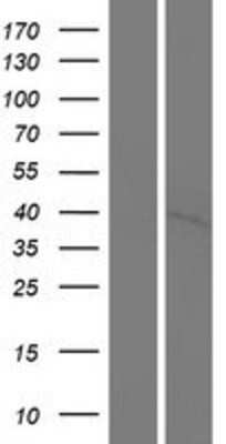 Western Blot: PNCK Overexpression Lysate [NBP2-10232]