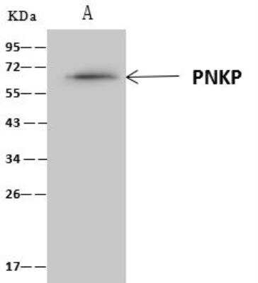Immunoprecipitation: PNK Antibody [NBP3-12588]