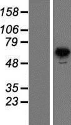 Western Blot: PNK Overexpression Lysate [NBP2-10374]