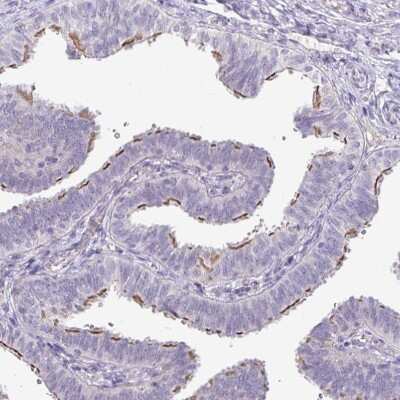 Immunohistochemistry-Paraffin: PNLDC1 Antibody [NBP2-13781]